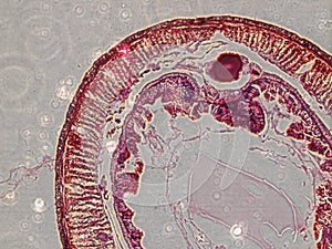 Microscopy images of intestine of earthworm photo