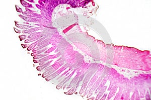 Microscopy photography. Small intestine transversal section.