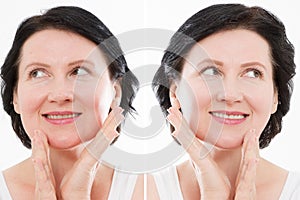 Middle age close up woman happy face before after cosmetic procedures. Skin care for wrinkled face. Before-after anti-aging