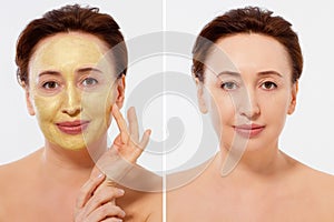 Middle age closeup woman face before after beauty mask treatment. Before-after wrinkled skin. Summer anti aging collagen mask on