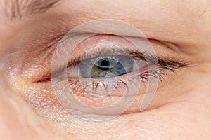 Middle age woman eye macro