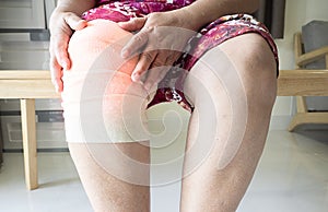 Middle aged adult woman suffering from arthritis disease and wearing elastic support knee