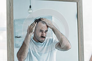 middle aged man with alopecia looking at mirror hair loss