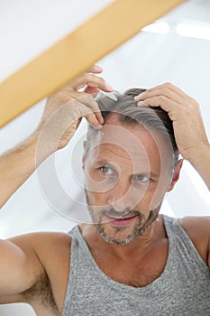 Middle-aged man applying hair loss treatment photo