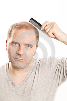 Middle-aged man concerned by hair loss Baldness alopecia Black and white