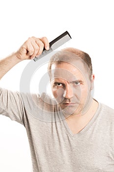 Middle-aged man concerned by hair loss Baldness alopecia Black and white