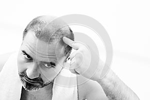 Middle-aged man concerned by hair loss Baldness alopecia close up black and white, white background