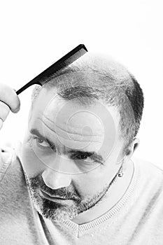 Middle-aged man concerned by hair loss Baldness alopecia close up black and white, white background