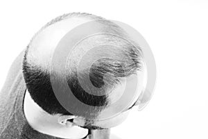 Middle-aged man concerned by hair loss Baldness alopecia close up black and white, white background