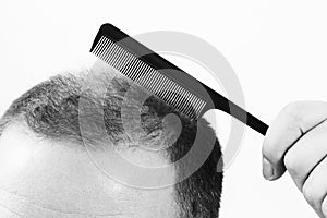 Middle-aged man concerned by hair loss Baldness alopecia close up black and white, white background