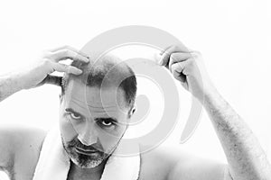 Middle-aged man concerned by hair loss Baldness alopecia close up black and white, white background