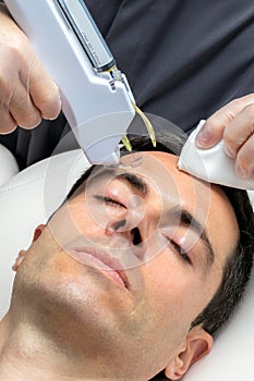 Middle aged man having facial mesotherapy with micro needle technology