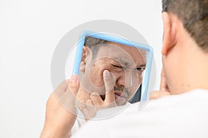 A middle-aged man looking in the mirror and worried about blemishes and wrinkles on his face photo