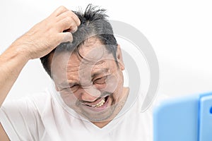 A middle-aged man scratch his hair on the scalp isolated on white