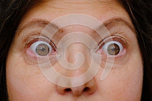 Middle-aged mature woman with bulging eyes, upper face close-up, goggle eyes in fright, staring at camera, Very strong surprise or