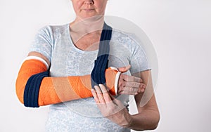 middle aged woman with broken arm in cast hangs her arm in a sling, modern treatment methods, on a neutral background