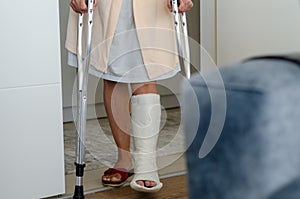 The middle aged woman with broken leg at home