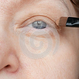 Middle-aged woman does corrective eye makeup to correct the drooping eyelid. Ptosis is a drooping of the upper eyelid, lazy eye.