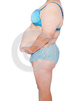 Middle aged woman with excess skin after babies and extreme weight loss. Side view, facing left holding excess belly skin.