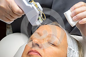 Middle aged woman having micro needle mesotherapy on forehead