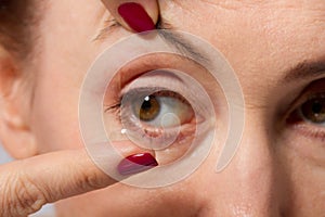 Middle aged woman with pouches under the eyes putting contact lens in her brown eye, close up and macro view. Medicine and vision