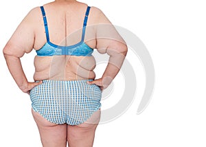 Middle aged woman with sagging skin after babies and extreme weight loss back view hands on hips, copy space right.