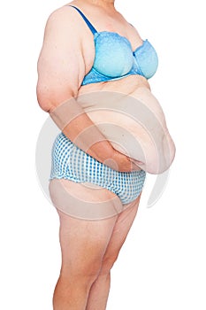Middle aged woman with sagging skin after babies and extreme weight loss. 45 deg view holding excess belly skin. photo