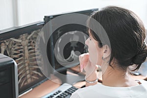 middle east woman doctor looking at monitor with chest bones computer tomography image. female young radiologist