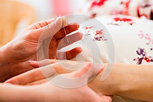 Midwife giving pregnancy acupuncture