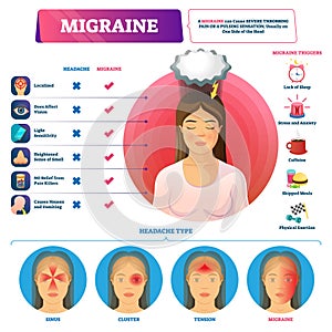 Migraine vector illustration. Labeled headache triggers and types scheme. photo