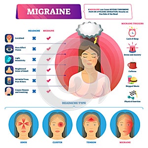 Migraine vector illustration. Labeled headache triggers and types scheme.