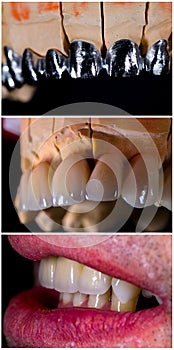 Mimicking nature in dentistry