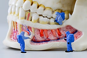 Miniature people scientist at work with dental tooth model