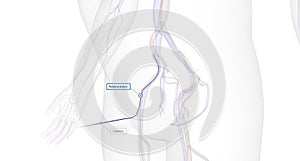 The Minimally Invasive Access for Embolectomy