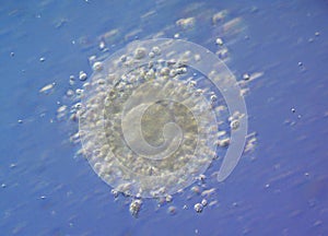 Miracle of life human ovum a spermatozoa, Microphotograpy FIV fertilization in vitro