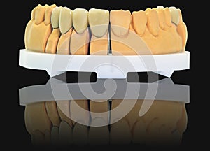 Mirroring denture