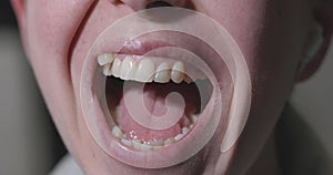 Misaligned Teeth with Prominent Canine Tooth Above the Dental Line