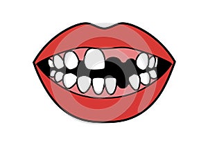 Missing teeth clipart