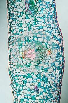 Mistletoe leaf in cross section