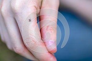 Mite on child`s hand. Dangerous tick on the skin crawls along the arm