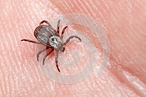 Mite crawling along a human skin macro