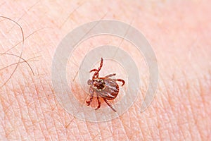 Mite on the skin. Danger of tick bite