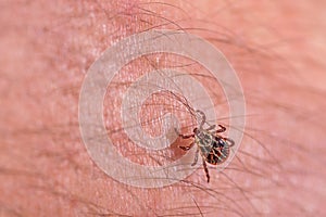 Mite on the skin. Danger of tick bite.