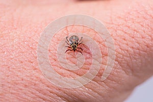 Mite on the skin. Danger of tick bite.