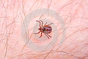 Mite on the skin. Danger of tick bite. photo
