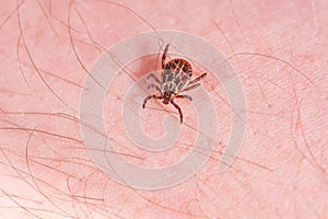 Mite on the skin. Danger of tick bite.