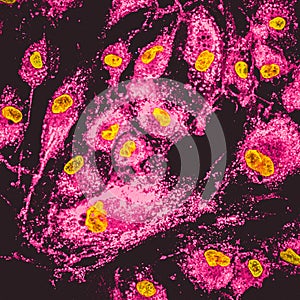 Mitochondria staining photo