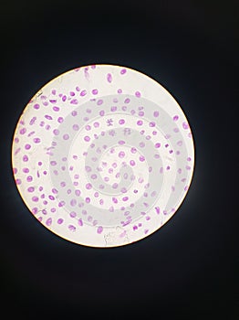 Mitosis cell division. Animal eukaryotic cell. Painted purple, seen in an optic microscope