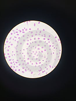 Mitosis cell division. Animal eukaryotic cell. Painted purple, seen in an optic microscope photo