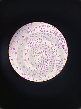 Mitosis cell division. Animal eukaryotic cell. Painted purple, seen in an optic microscope photo